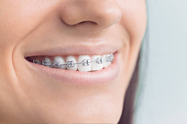 Best Tooth Extraction  in Frankfort, IL